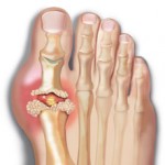 Why Do My Feet Hurt? 10 Common Causes of Foot Pain