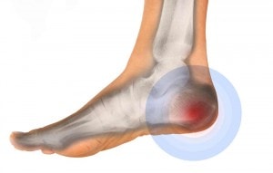 Pain on side on sale of heel bone