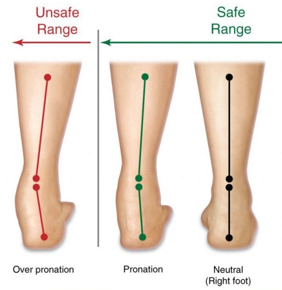 Pronation and supination. How to recognise and solve them