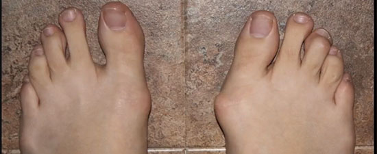 Foot and Ankle Blog - Page 7 of 9
