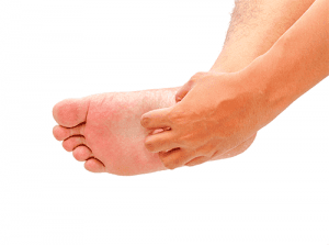 How Hyperkeratosis Can Affect Your Feet