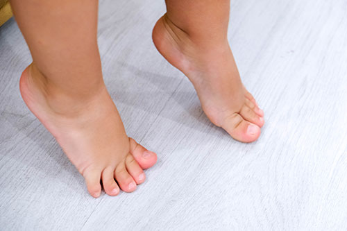 Are My Baby's Feet Swollen or Fat: Learn How to Tell